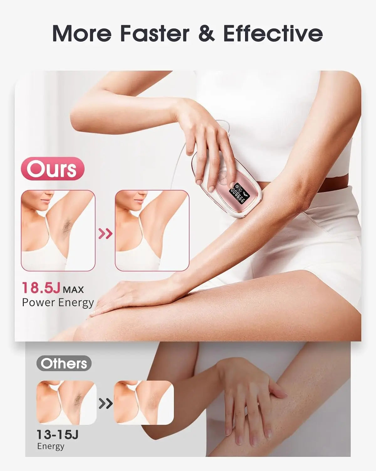 Bare Muse SilkTouch IPL Hair Removal